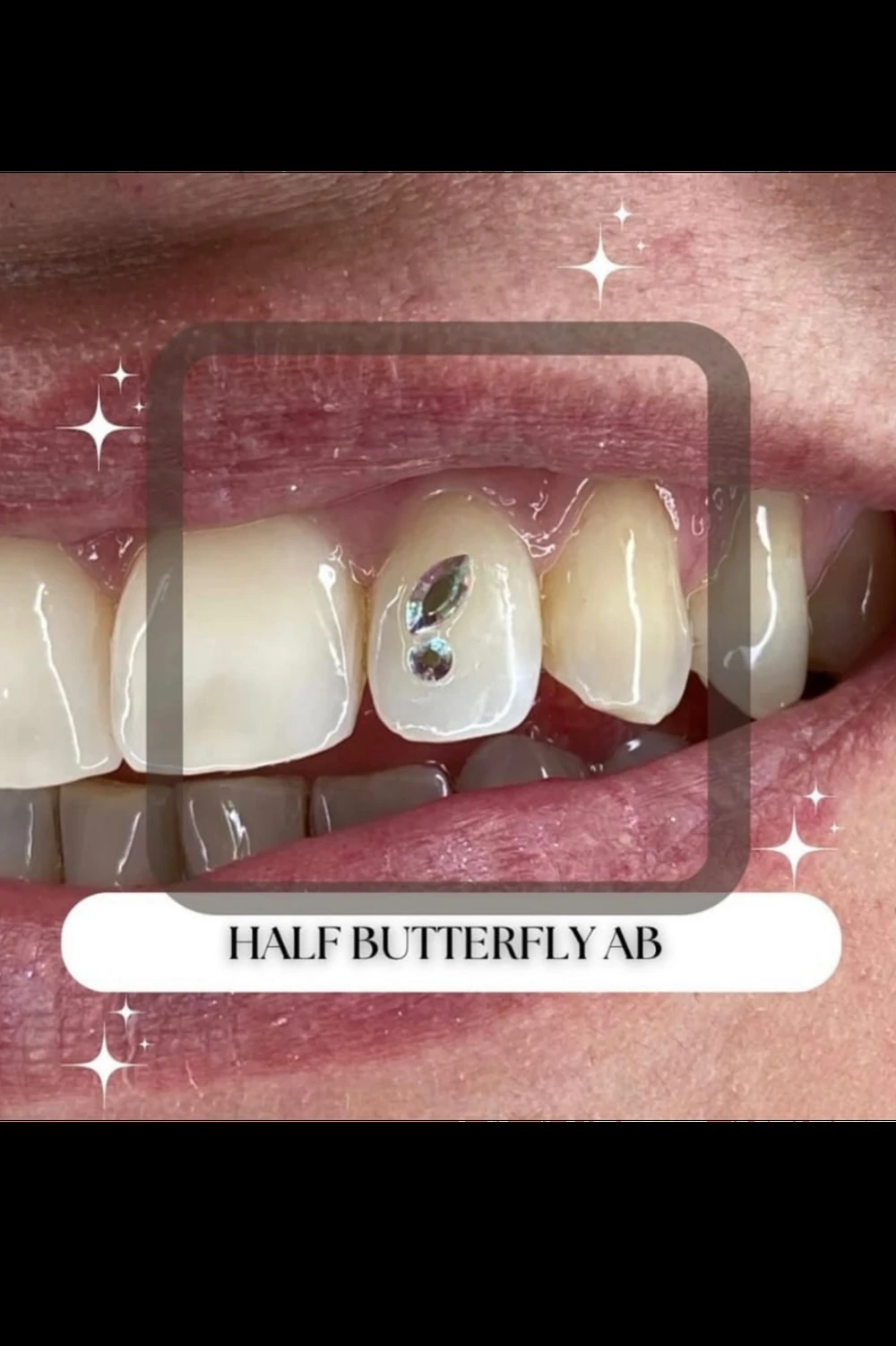 Foto Tattoo Piercing Dermo Seabird gemme dentali